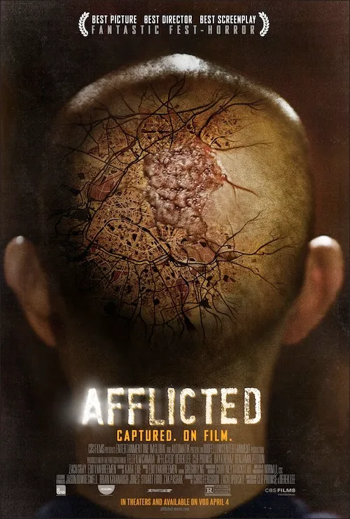 پوستر Afflicted
مبتلا